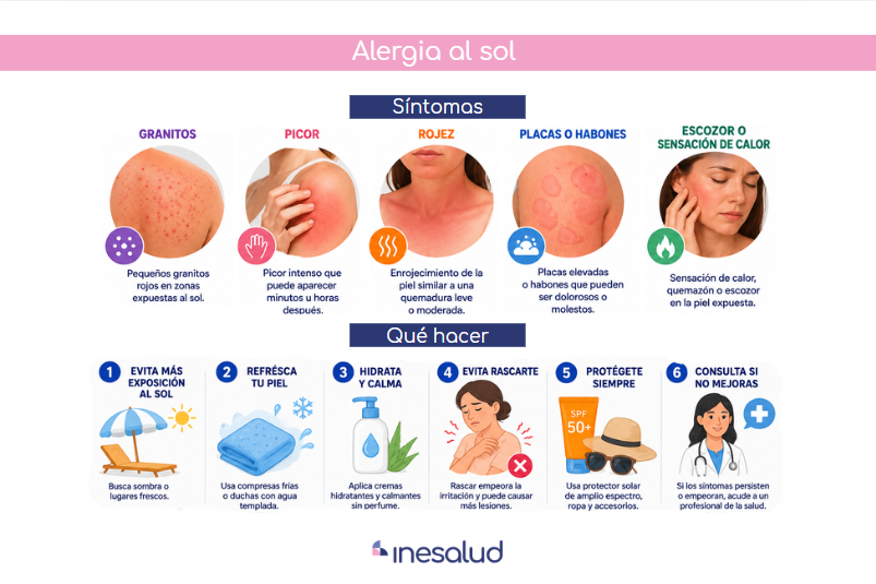 Síntomas y que hacer frente a la alergia al sol