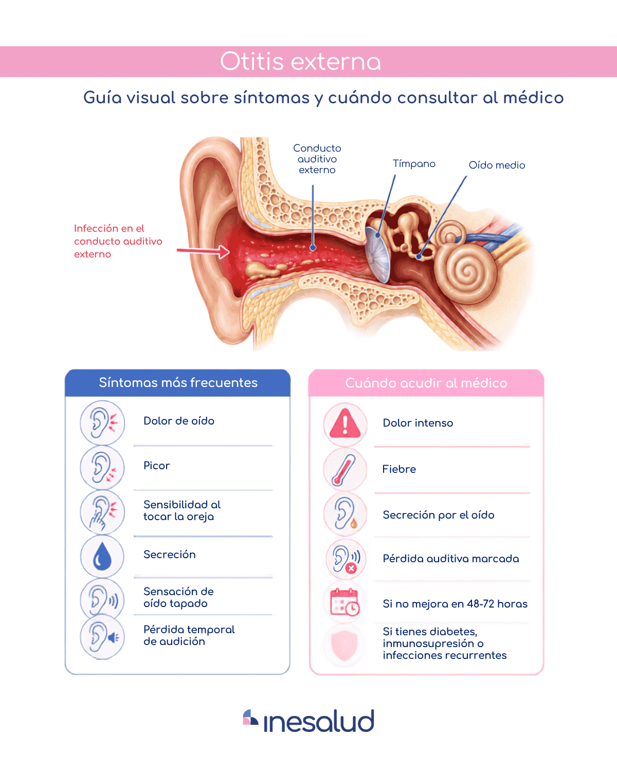 Guía visual sobre la otitis externa: localización de la infección, síntomas frecuentes y señales para consultar al médico.