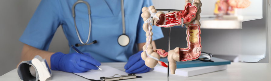 cribado de cáncer de colon