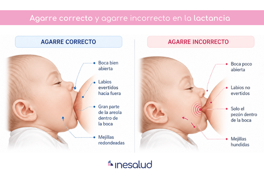agarre correcto en la lactancia