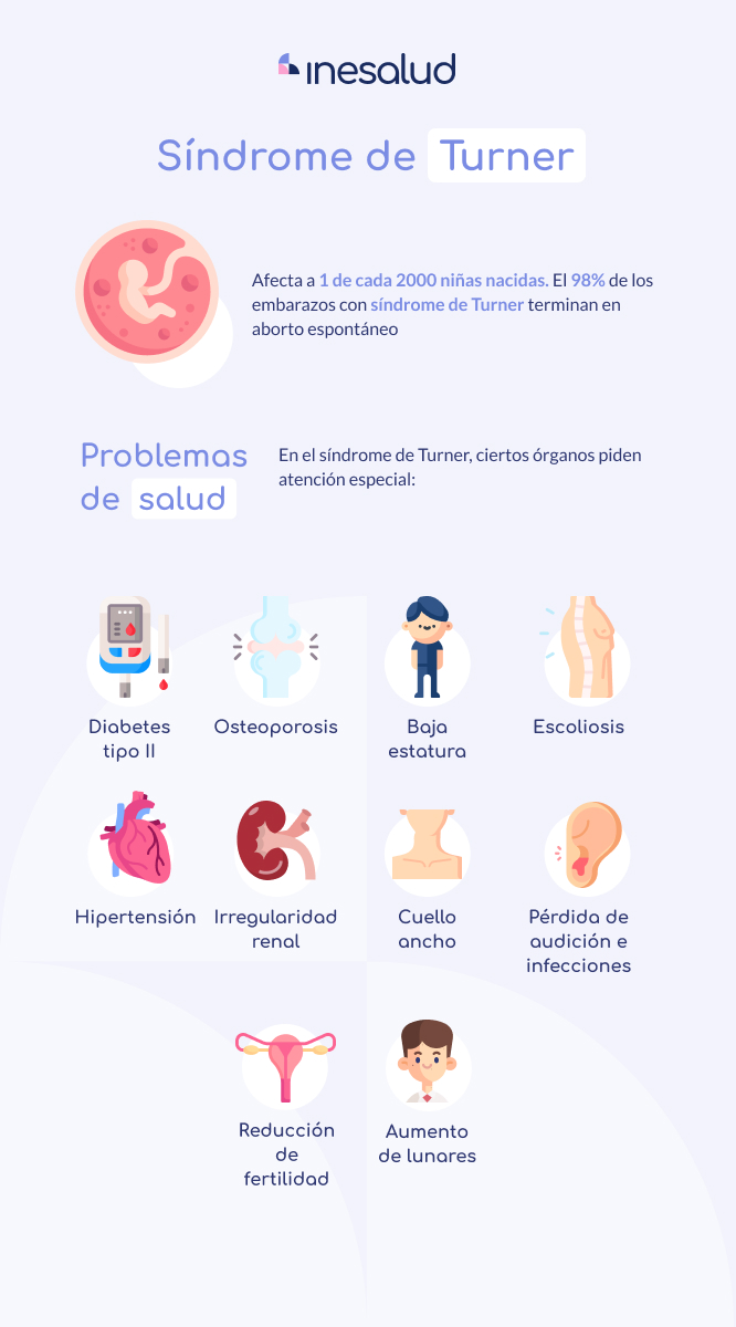 Síndrome de turner