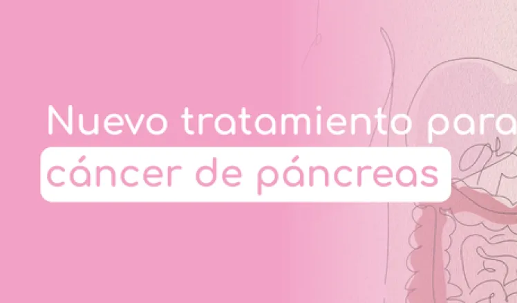Nuevo tratamiento cáncer de páncreas