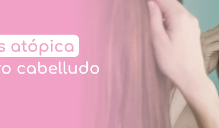 dermatitis atopica en el cuero cabelludo