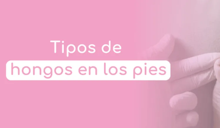 hongos pies