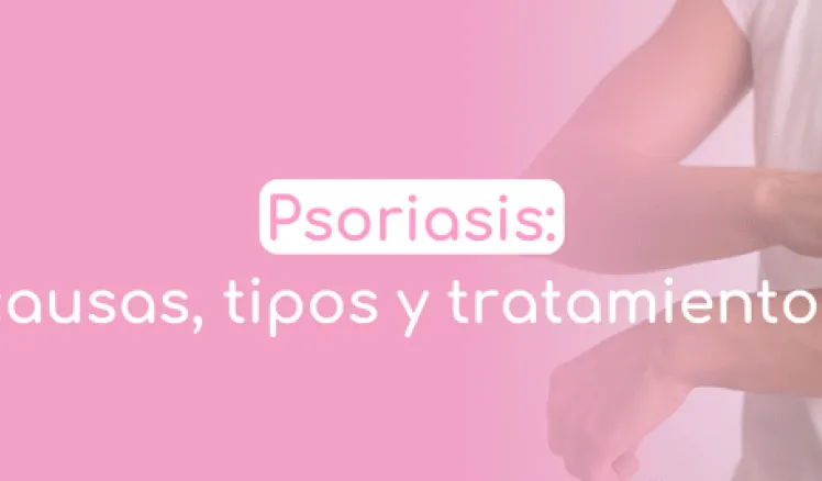 causas de la psoriasis