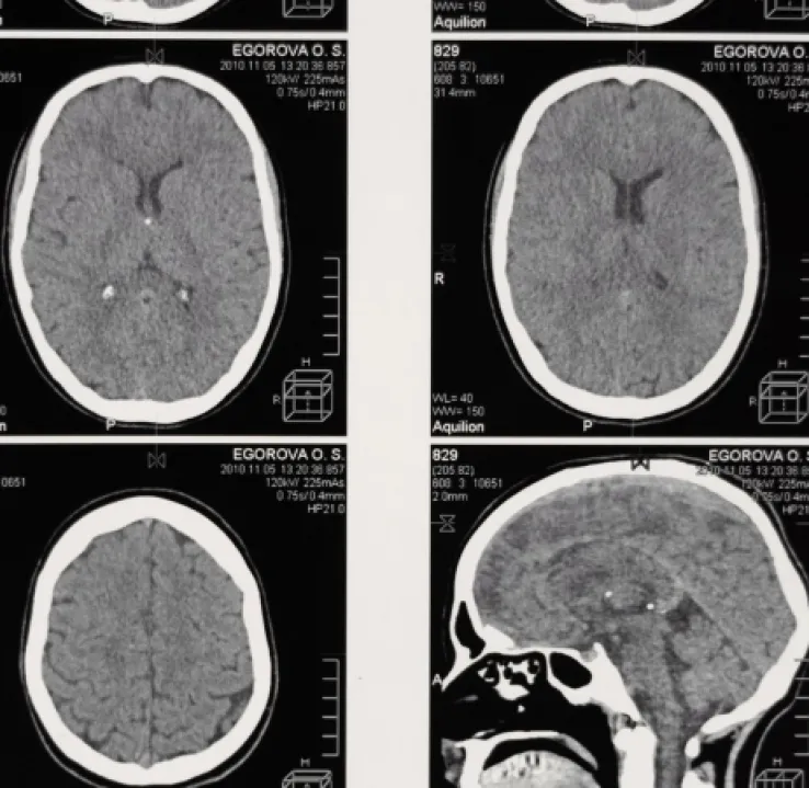 Curso de Técnicas de Neuroimagen
