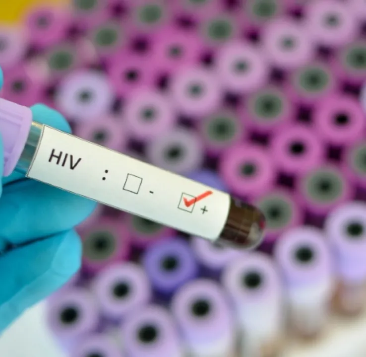Curso en Investigación del VIH: Gestión de Proyectos